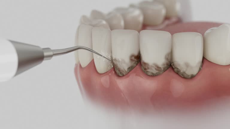 Trusted Invisalign Clear Aligners service in Garden City, MO - Dentist Open Now